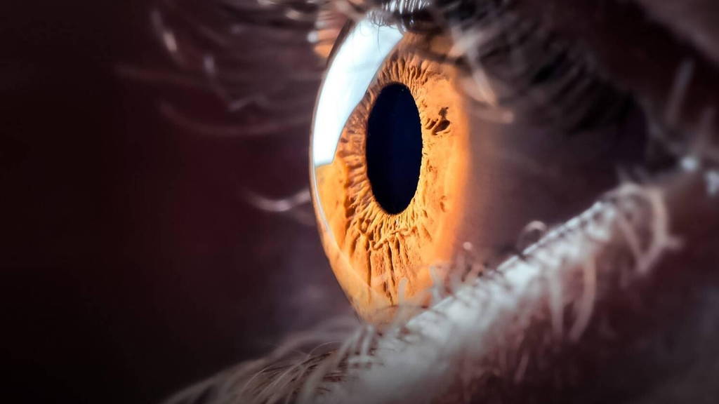 diabetische-retinopathie-oog