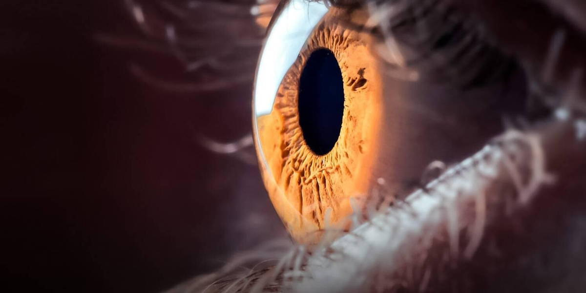 diabetische-retinopathie-oog
