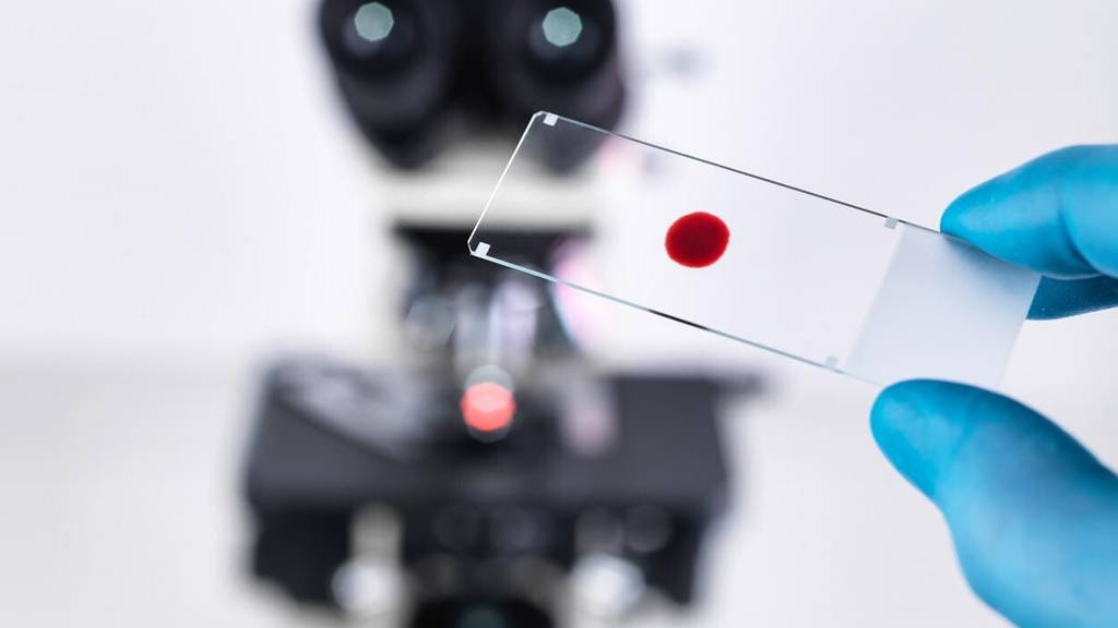 Laboratory scientist holding a slide containing a blood sample with a upright compound microscope in the background
