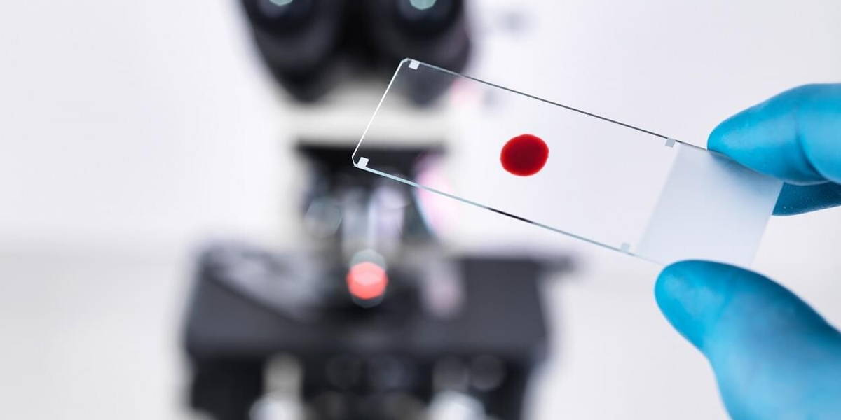 Laboratory scientist holding a slide containing a blood sample with a upright compound microscope in the background