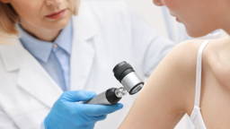 AI predicts melanoma tisk up to five years in advance