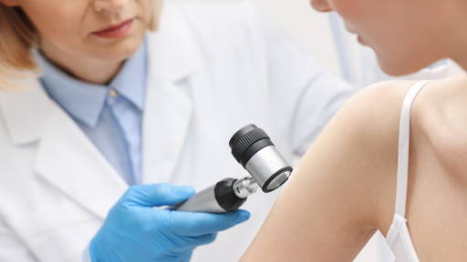 AI predicts melanoma tisk up to five years in advance