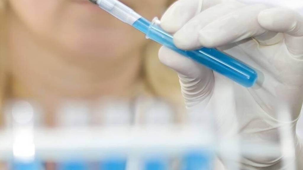 Laboratorium-onderzoek