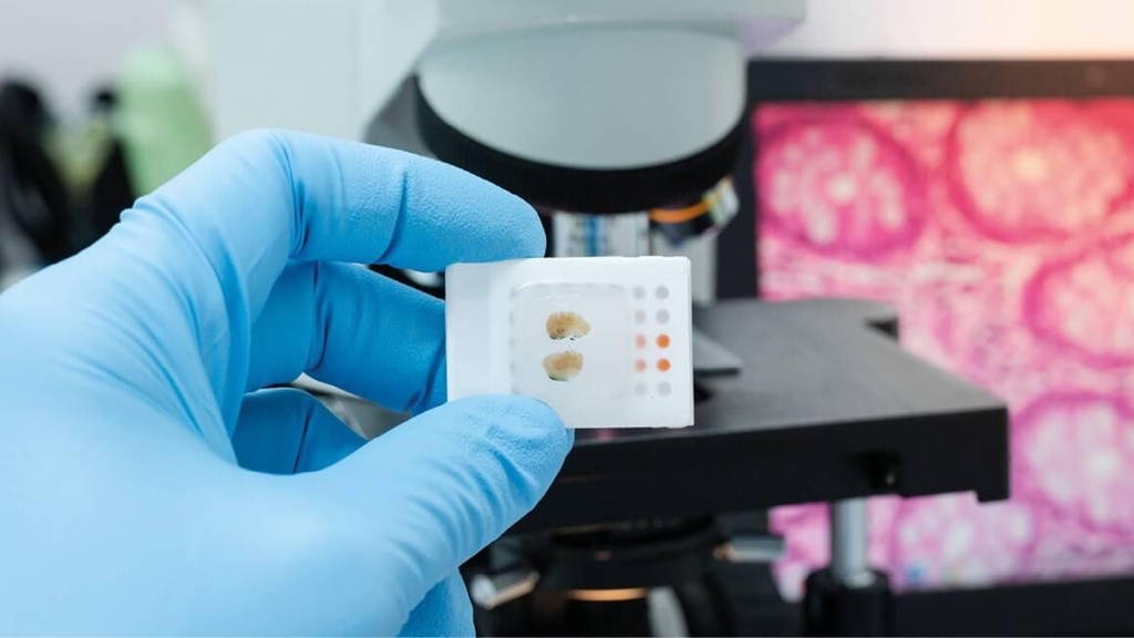 Digitale pathologie en AI op een kruispunt