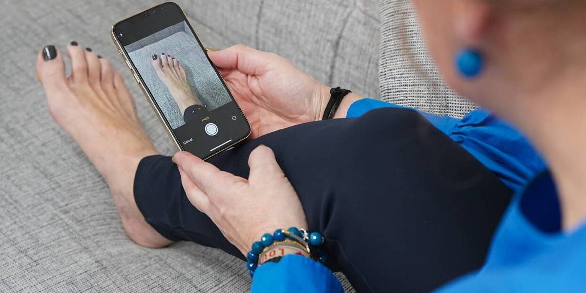 Technologie helpt diabetische voetenzorg vooruit