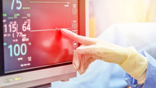 Diagnosing cardiac arrhythmias with AI-enhanced MRI