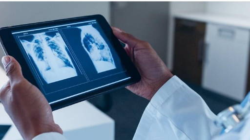 ‘Radiologen moeten mogelijkheden technologie ten volle benutten’