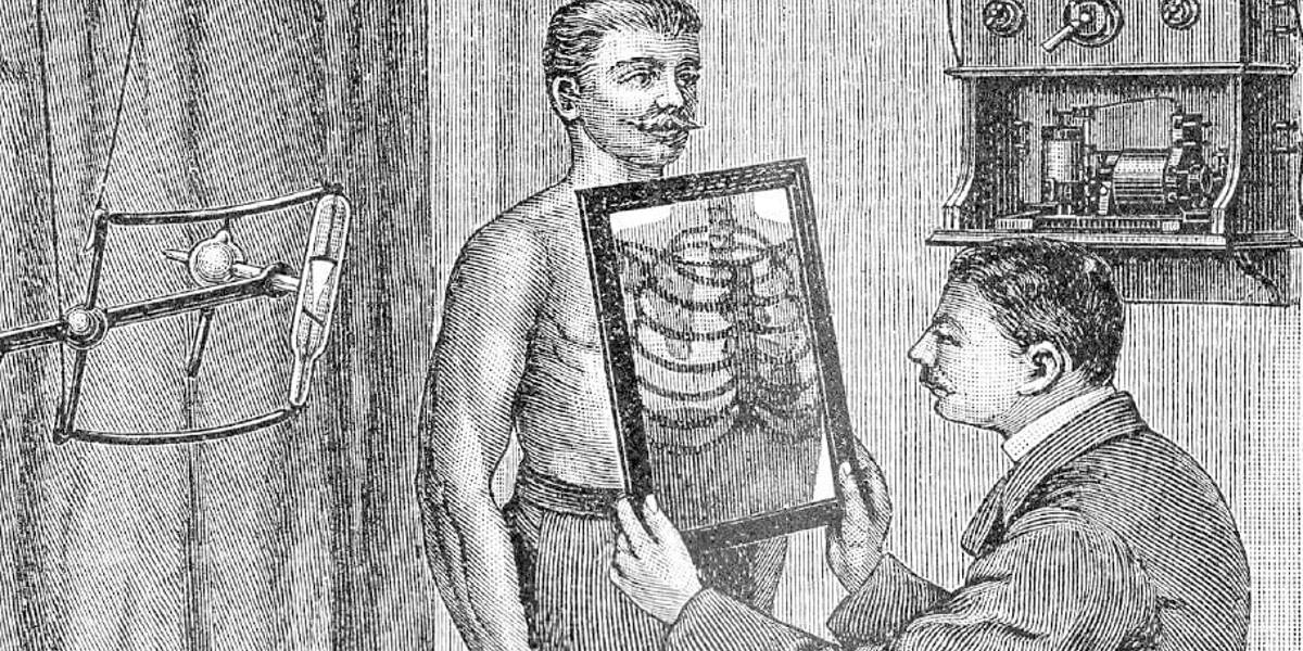 Zonder speelfase géén snelle vooruitgang