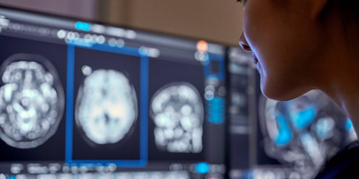 Philips-RSNA-Innovaties