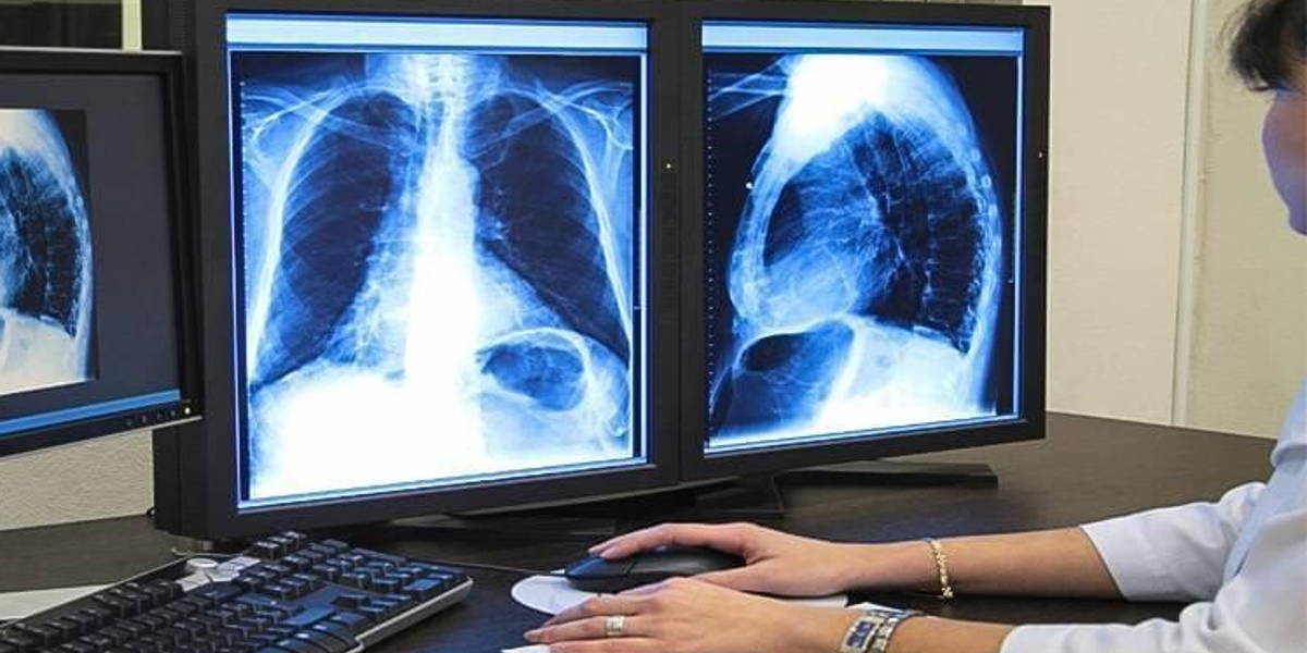 digitaal-mri-scan-ICThealth