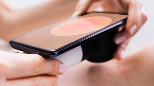 When smartphone images misrepresent clinical truth