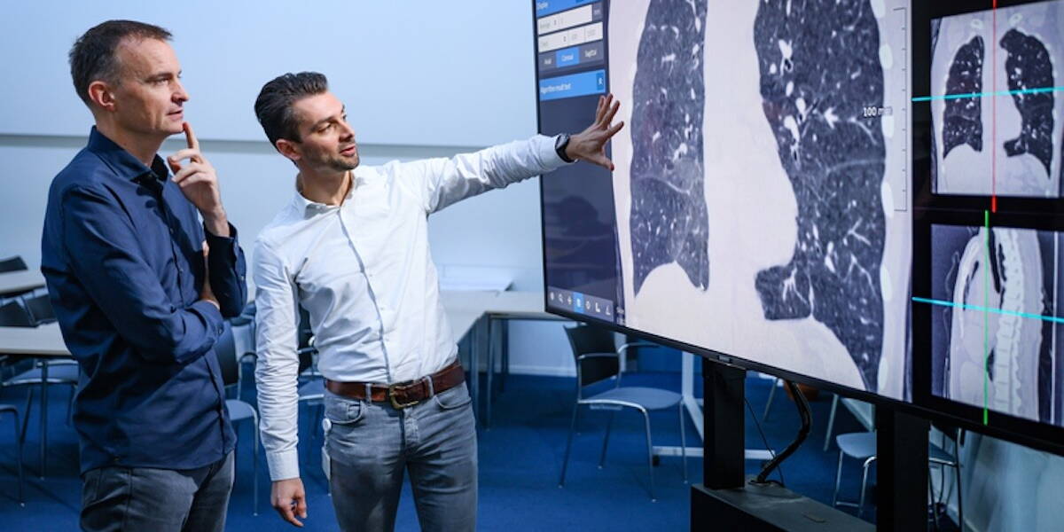 Artsen bekijken screening van long kanker