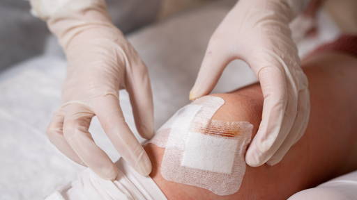 Slimmere ECD-registratie verhoogt kwaliteit wondzorg