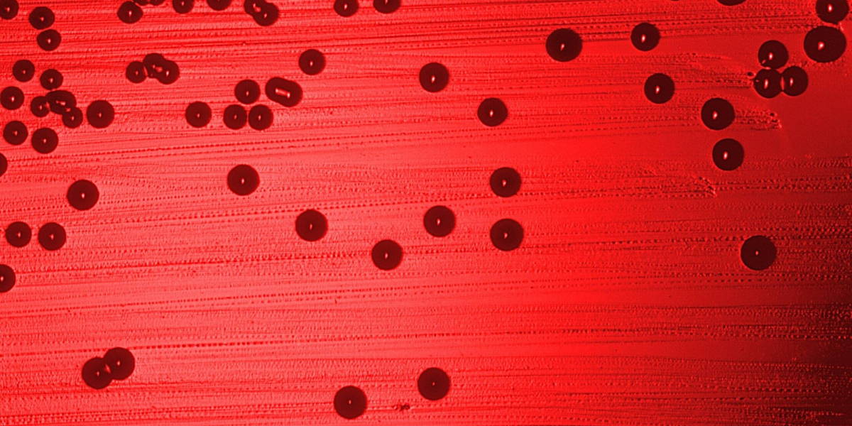 Haemophilus_influenzae_011-scaled