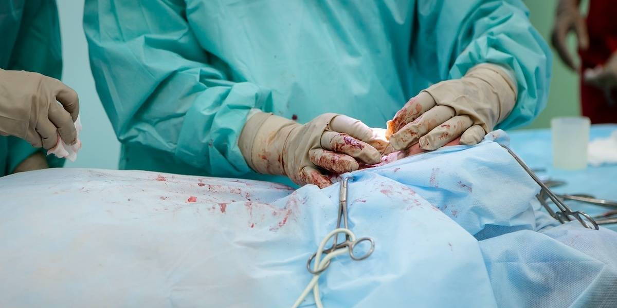 Chirurgie-Transplant