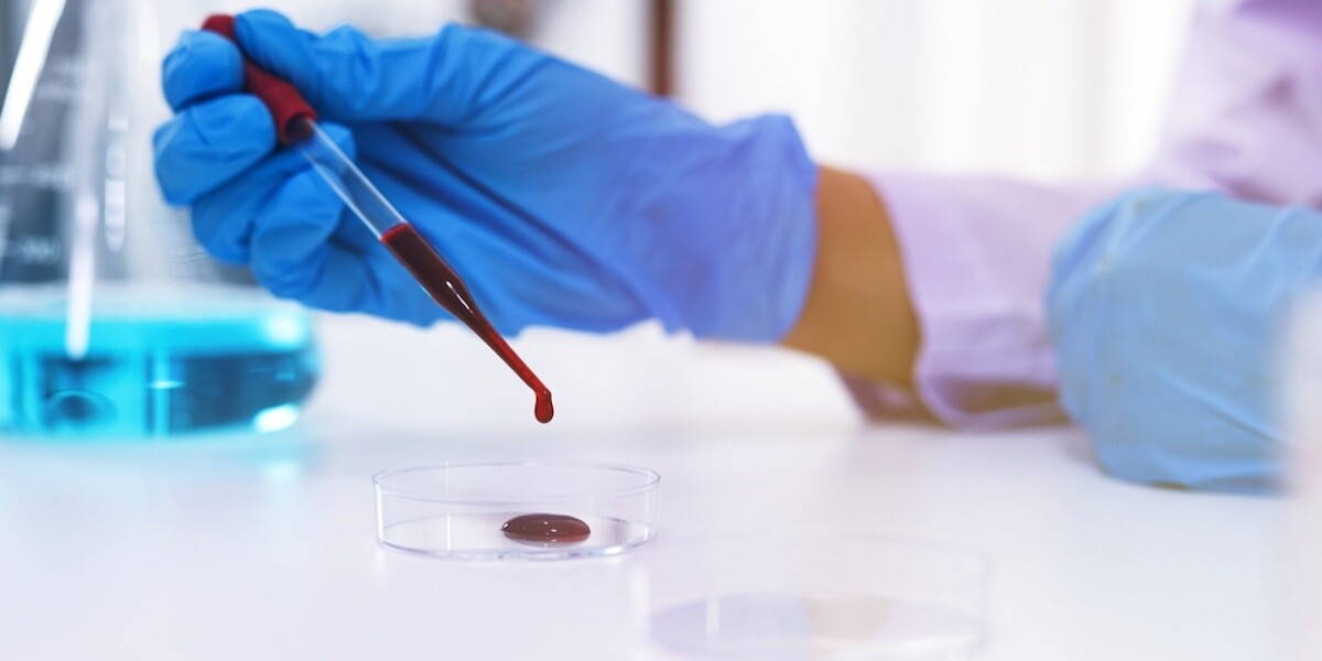 Scientist holding Coronavirus covid-19 infected blood sample tube DNA testing of the blood in the laboratory with blood sample collection tubes and syringe Coronavirus Covid-19 vaccine research.