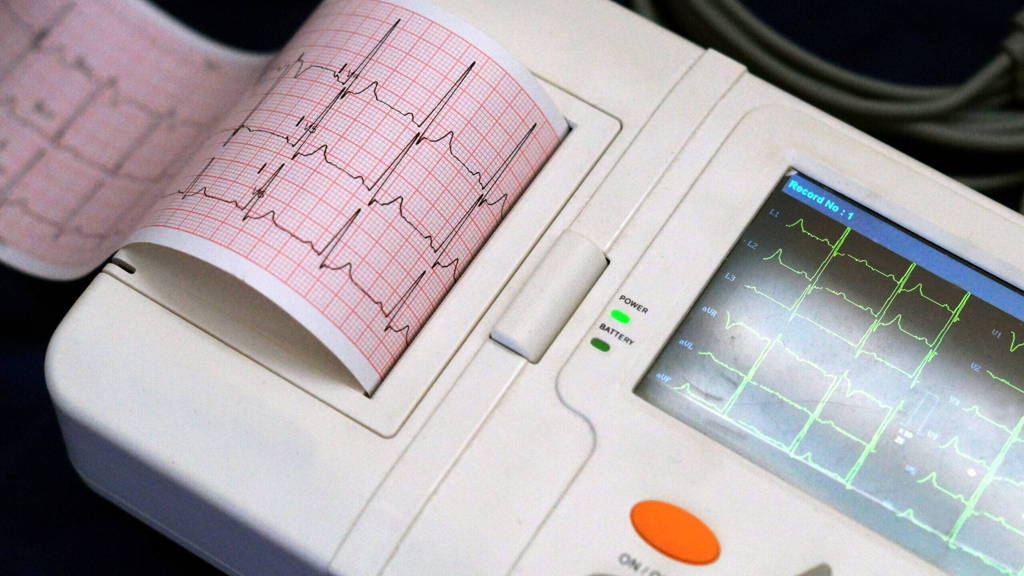 Help, er zit een hacker aan het echoapparaat