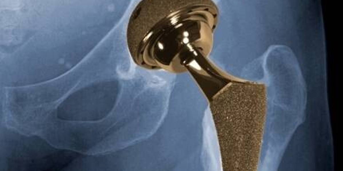 hip_implant