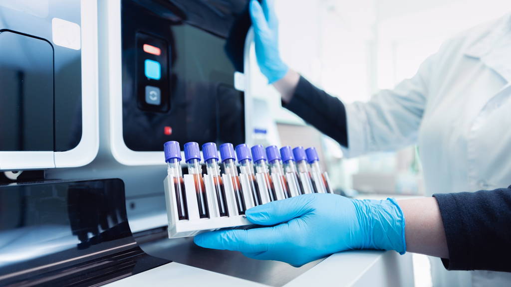 Koppeling LOINC-codes aan LESA verbetert digitale gegevensuitwisseling