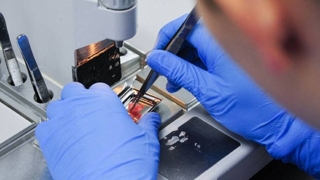 Digitale Technologie stuwt oncologie vooruit