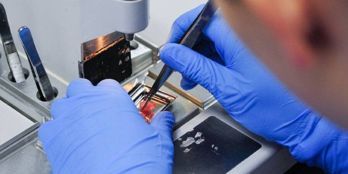 Digitale Technologie stuwt oncologie vooruit