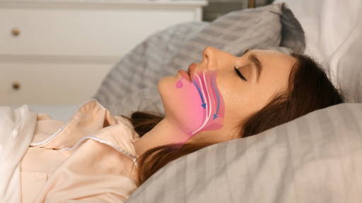 Mobiele technologie voor betere diagnose slaapapneu na beroerte