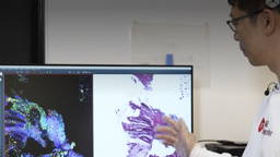 AI geeft pathologen ‘superzicht’ op verborgen kanker