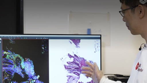 AI geeft pathologen ‘superzicht’ op verborgen kanker