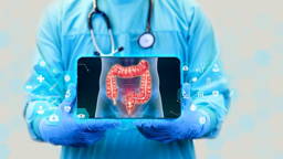 Reactie op behandeling darmkanker voorspellen via gekweekte organoïden