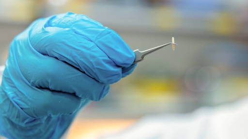 Injecteerbaar implantaat biedt alternatief voor chirurgie