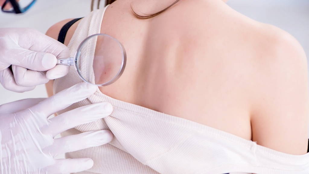 Doctor examining the skin of female patient