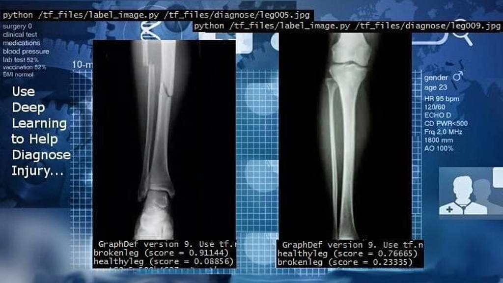 Deeplearning2_edited