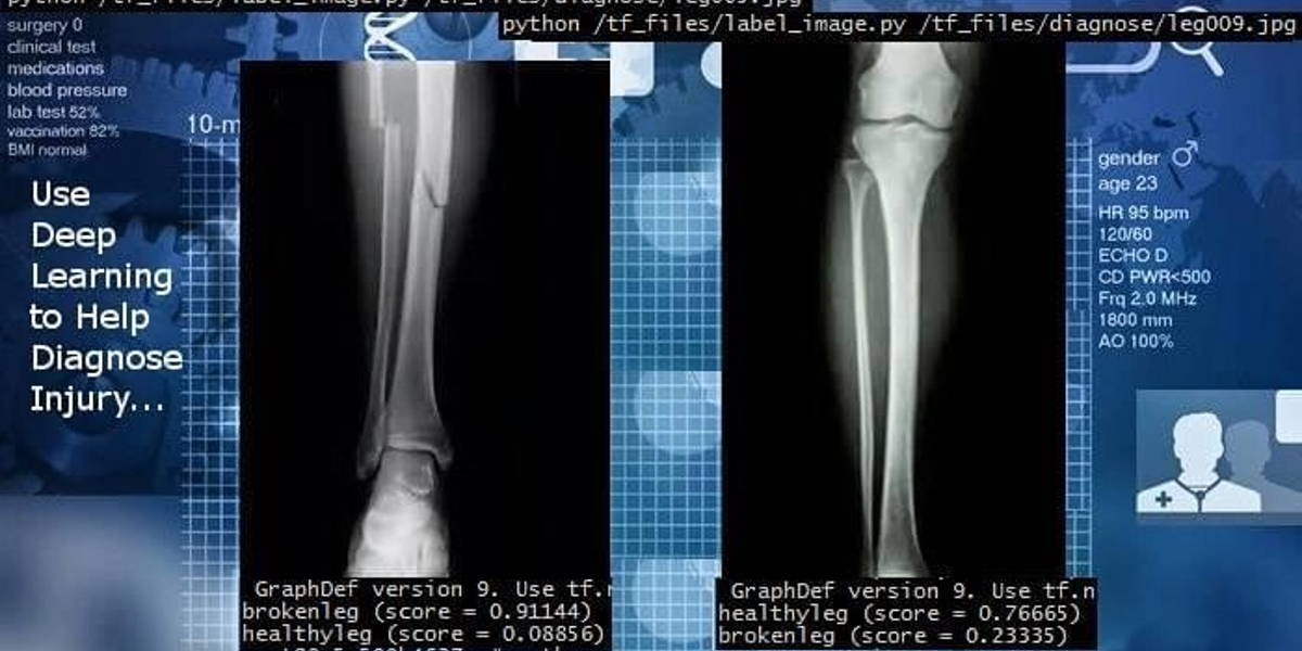 Deeplearning2_edited