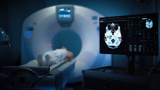 7 Tesla MRI toont hoe het brein lichaamsbehoeften reguleert