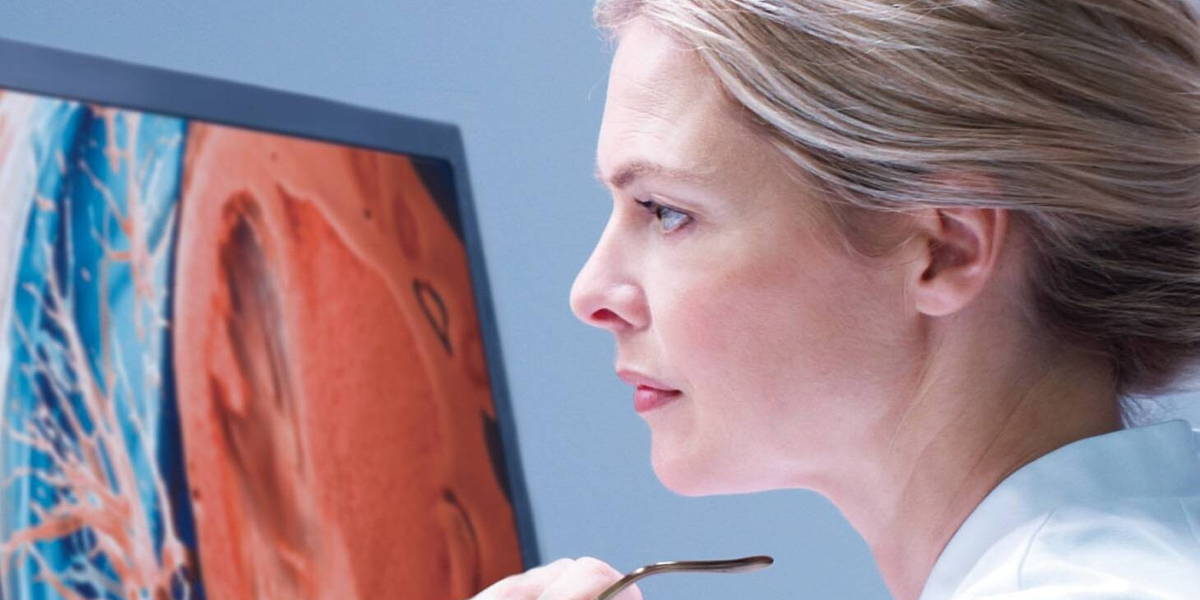 Philips-diagnostiek-radiologie-beelden