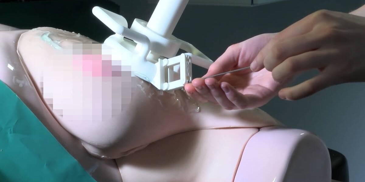 Murab-Robot-Borstkanker