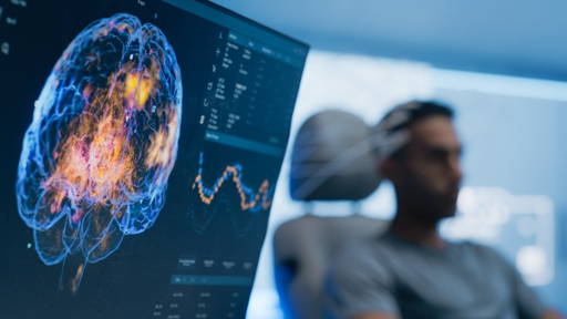 Nieuwe imagingtool versnelt hersenonderzoek