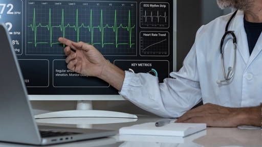 AI spoort verborgen hartziekte op met standaard ECG