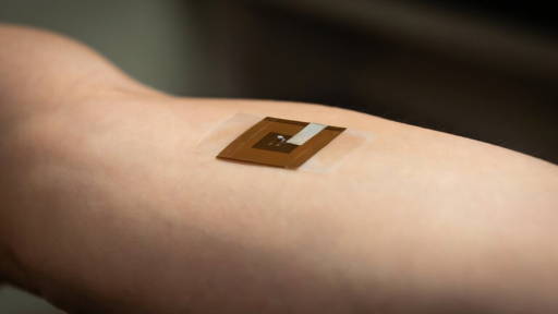 Slimme chiploze pleister spoort huidkanker vroegtijdig op