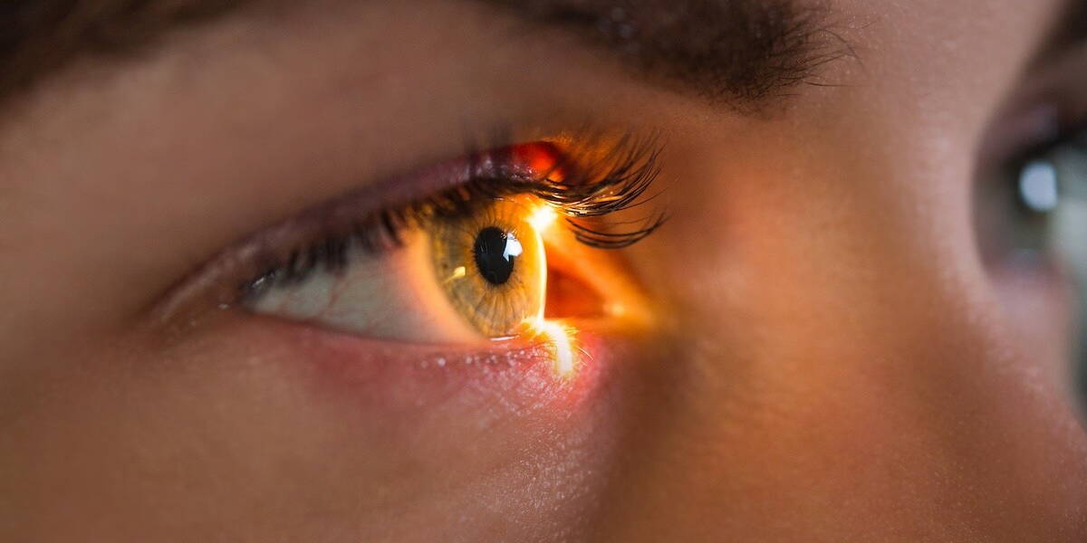 Retina-onderzoek met licht in oog