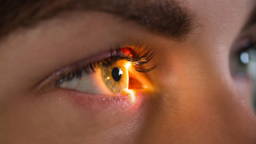 Met retinabeelden ALS en Alzheimer diagnosticeren