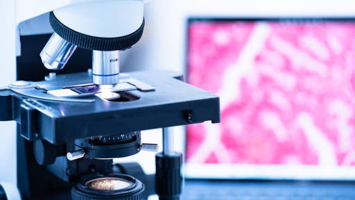 Tumor-op-chip onthult gedrag alvleesklierkanker