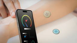 Smart patch could warn allergy patients before reactions begin