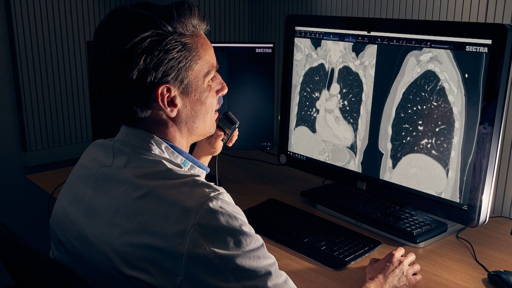 Versnelde inzet AI voor vroegtijdige longkankerscreening