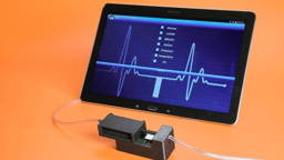 Digitale en functionele biomarkers: van meting naar vroegsignalering