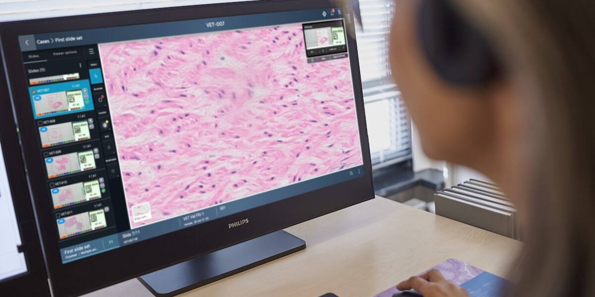 arts werkt met digitale pathologie