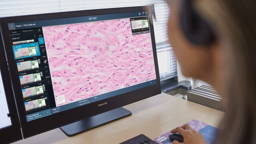 Nieuwe cloudoplossing voor digitale pathologie van Philips