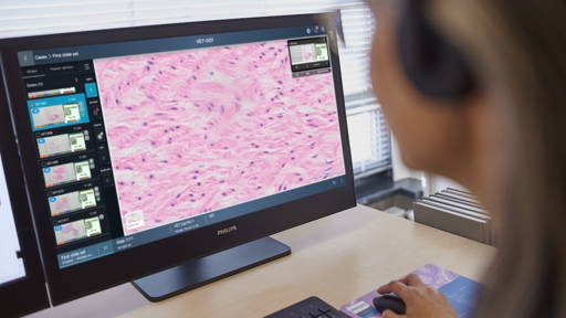 Nieuwe cloudoplossing voor digitale pathologie van Philips