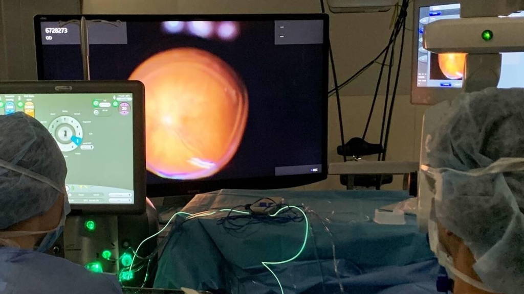 Digitale-Operatiemicroscoop