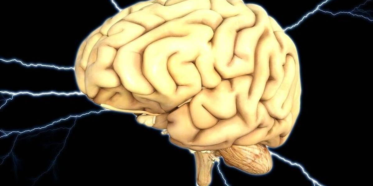 brain-1845940_960_720